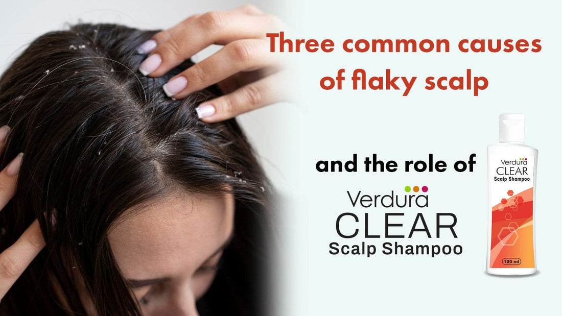 Three Common Causes of Flaky Scalp and the Role of Verdura Clear Scalp Shampoo